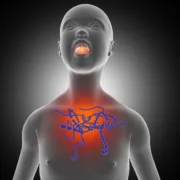 3D medical image with image depicting child with Strep A virus